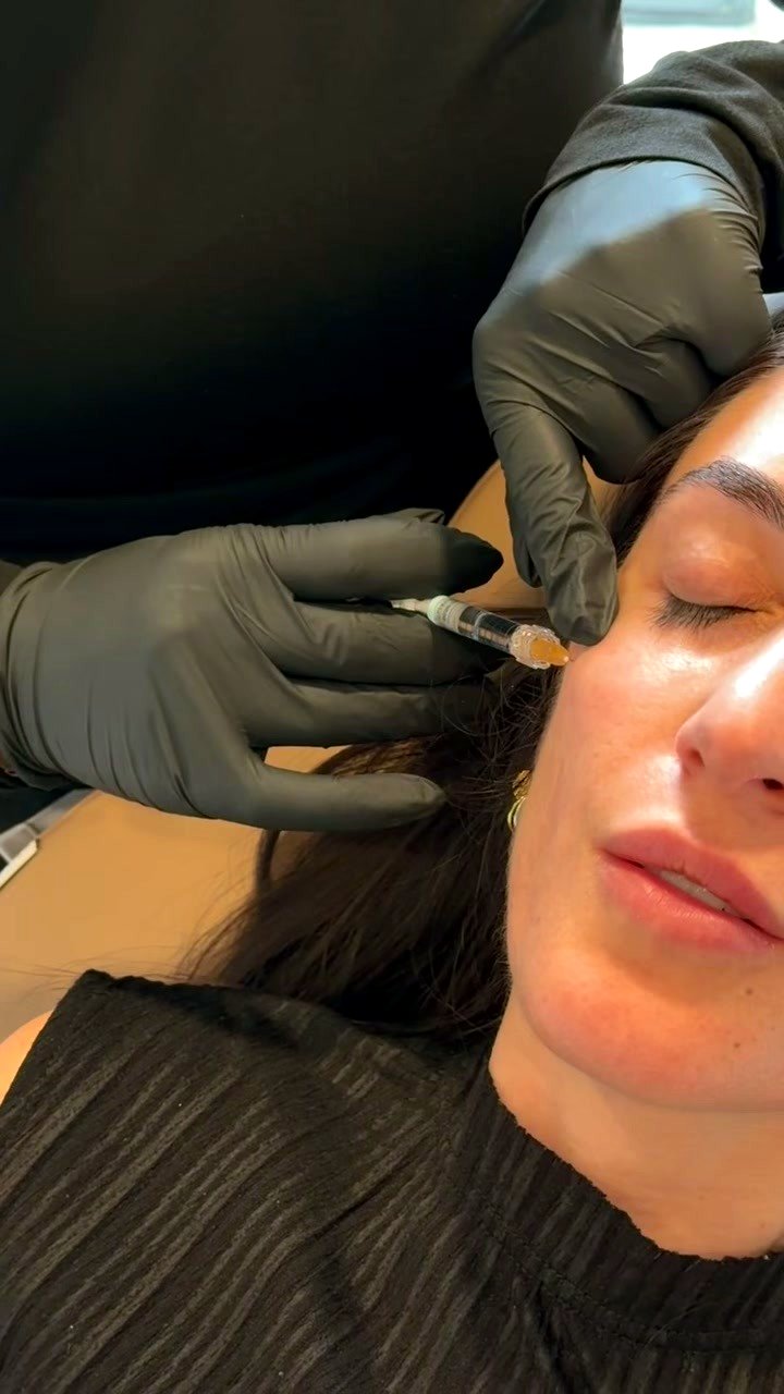 Neurotoxins at Aluna Aesthetics
