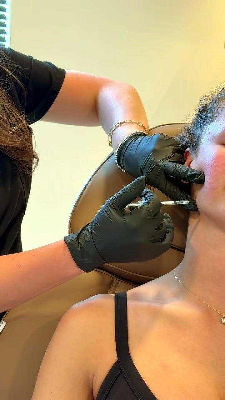 Neurotoxins at Aluna Aesthetics