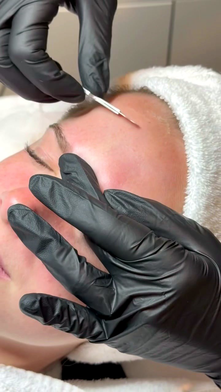 Dermaplane + Restore at Aluna Aesthetics
